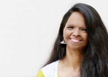 acid attack survivor